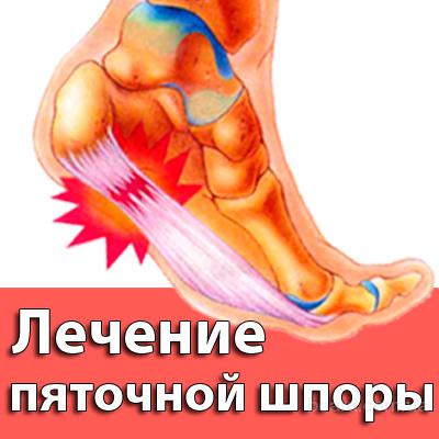 Болят вены ног лечение народными средствами